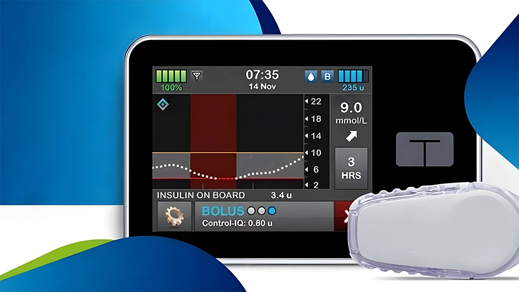 FDA Approves First Device to Enable Automated Insulin Dosing for Individuals with Type 2 Diabetes