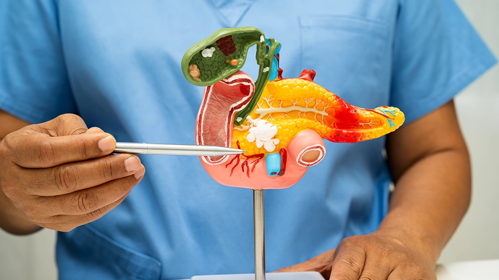 Tap into Mexico’s POC Diagnostics Market for Pancreatic Cancer – Act Fast, As the Market is Gaining Momentum!